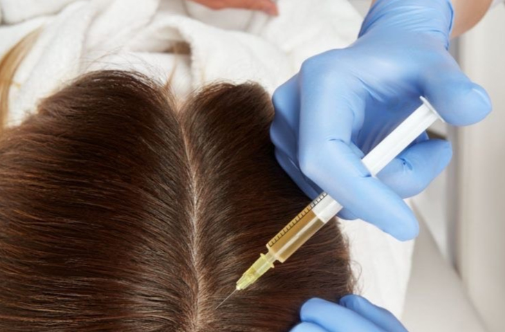 Tratamiento para alopecia
