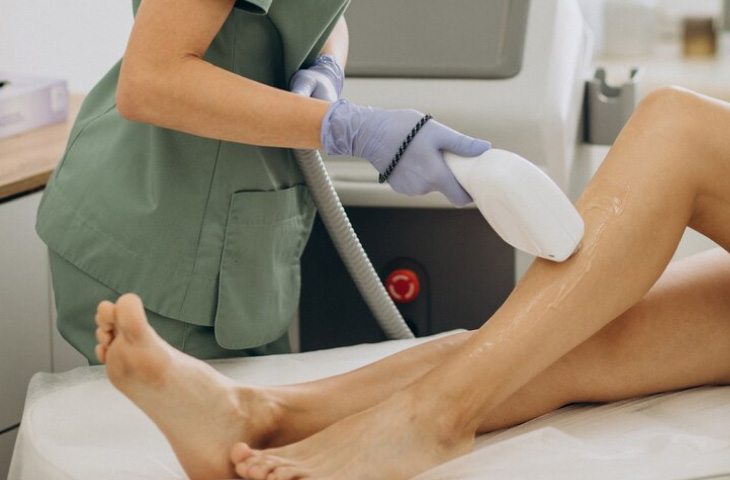 Depilación Laser